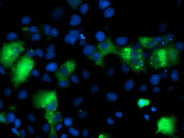 IRF6 Antibody in Immunocytochemistry (ICC/IF)