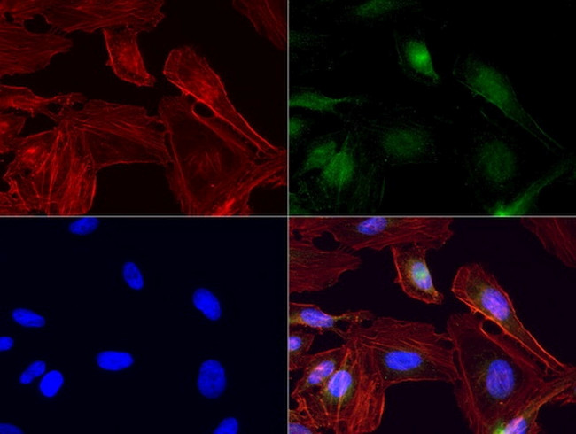 IRF6 Antibody in Immunocytochemistry (ICC/IF)