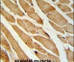 ISLR Antibody in Immunohistochemistry (IHC)