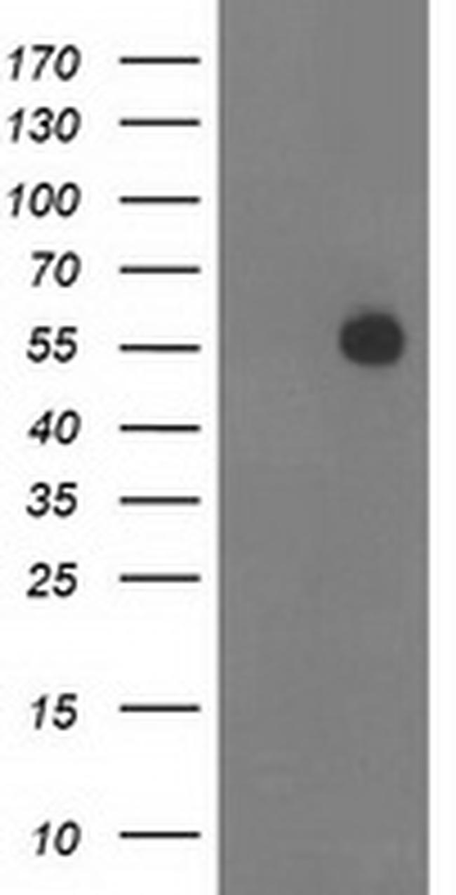 ITFG2 Antibody in Western Blot (WB)