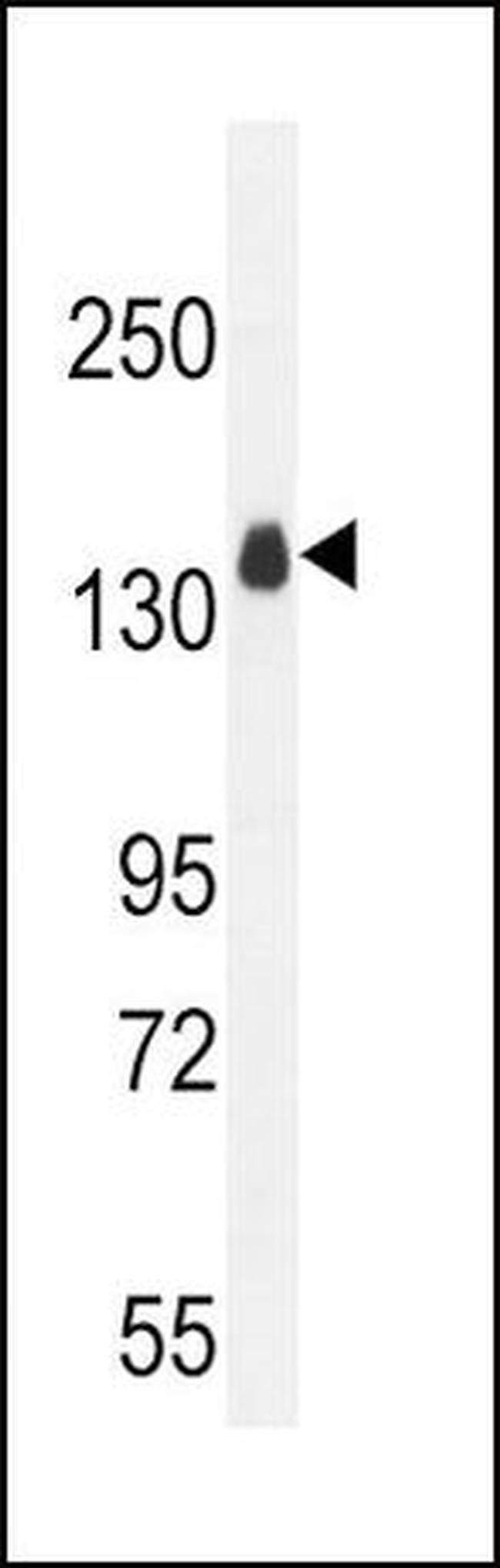 ITGA11 Antibody in Western Blot (WB)