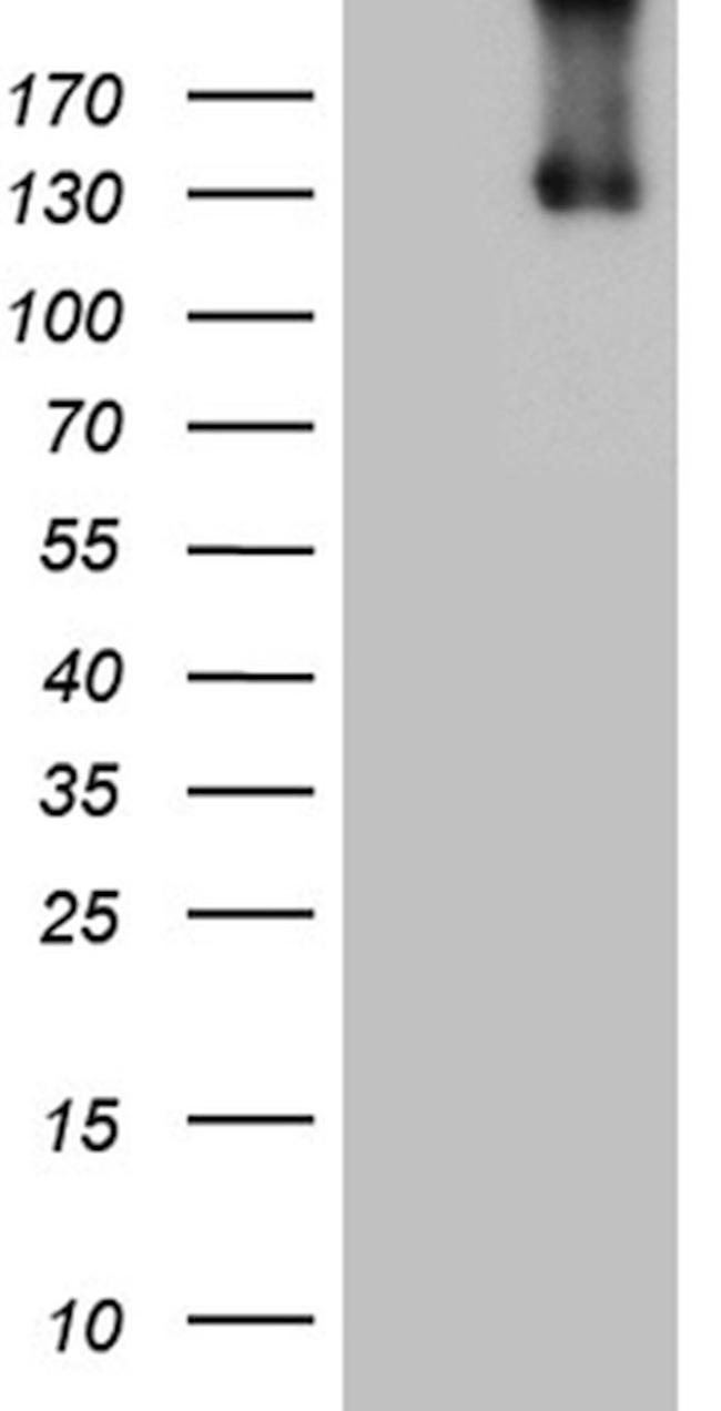 ITGAD Antibody in Western Blot (WB)