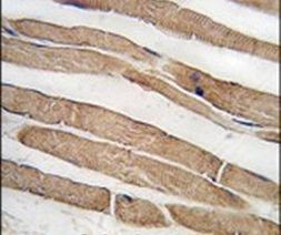 ITGB1BP3 Antibody in Immunohistochemistry (IHC)