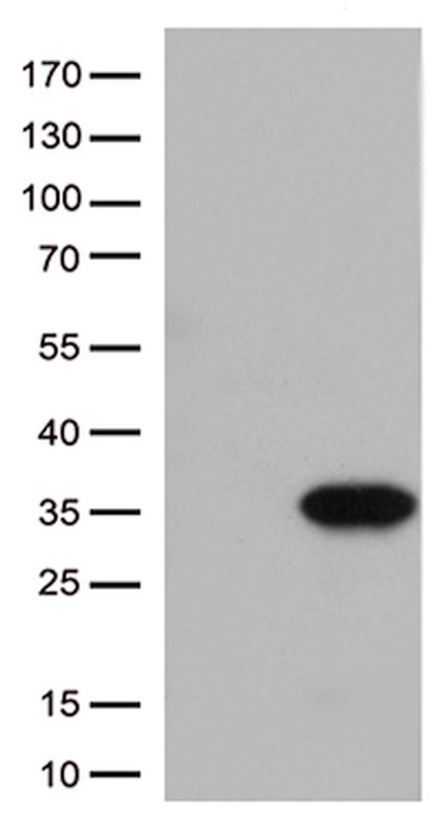 ITGB1BP3 Antibody in Western Blot (WB)