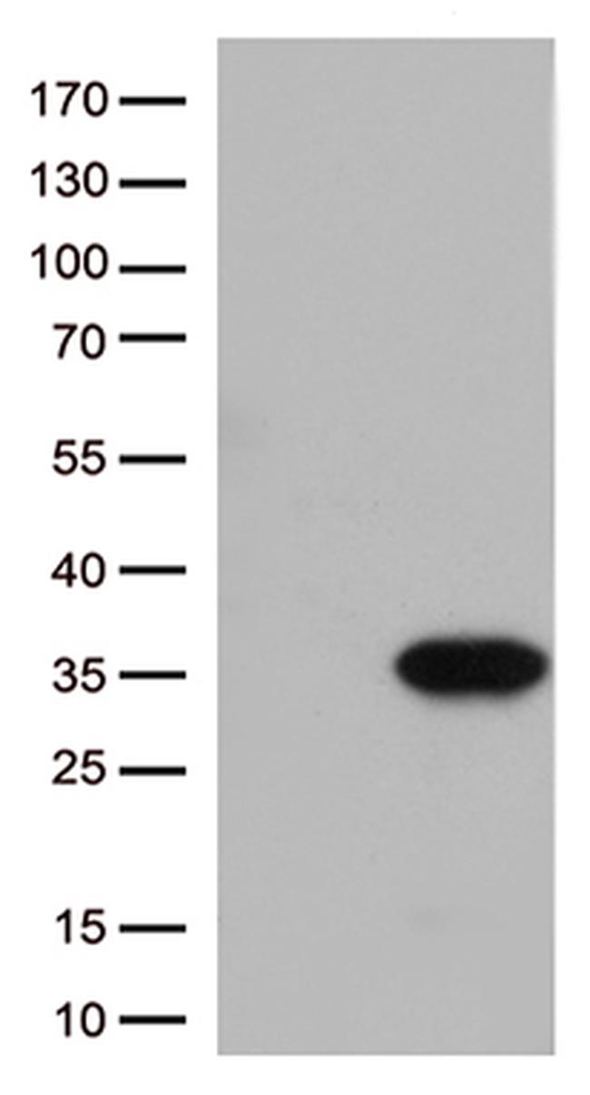 ITGB1BP3 Antibody in Western Blot (WB)