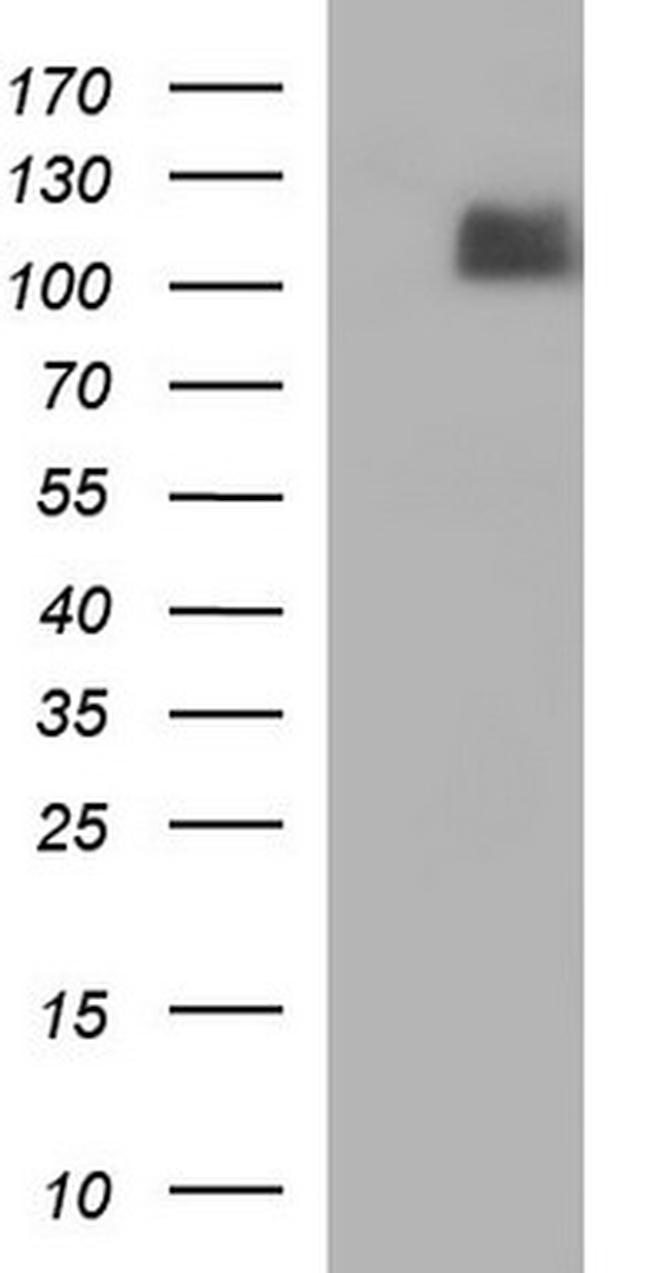 ITGB6 Antibody in Western Blot (WB)