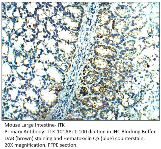 ITK Antibody in Immunohistochemistry (IHC)