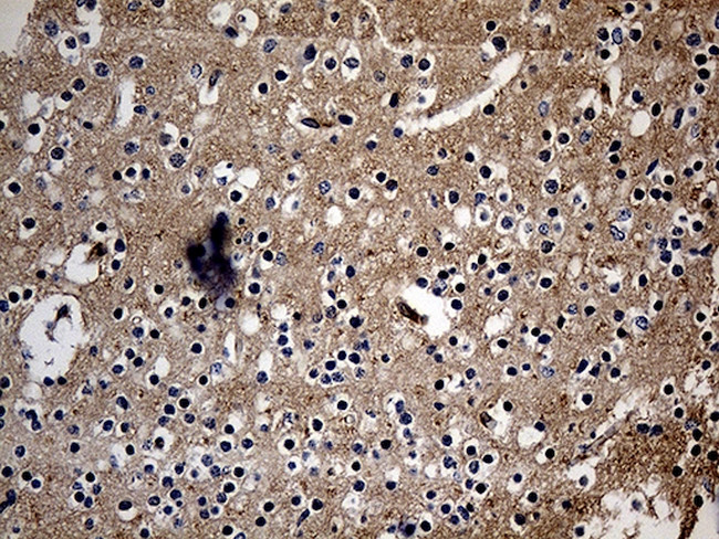 ITM2A Antibody in Immunohistochemistry (Paraffin) (IHC (P))
