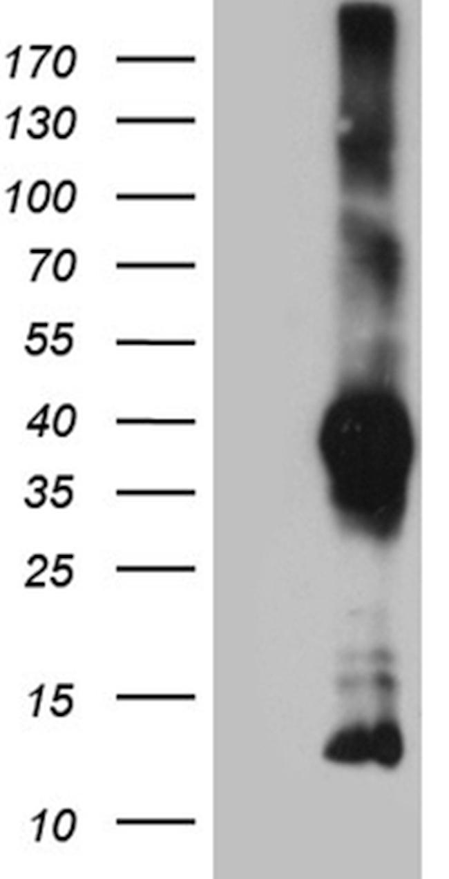 ITM2A Antibody in Western Blot (WB)