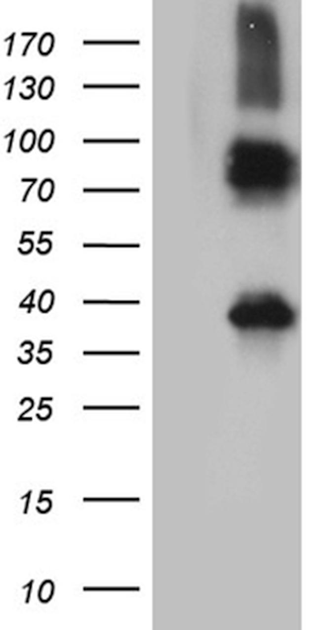 ITM2A Antibody in Western Blot (WB)