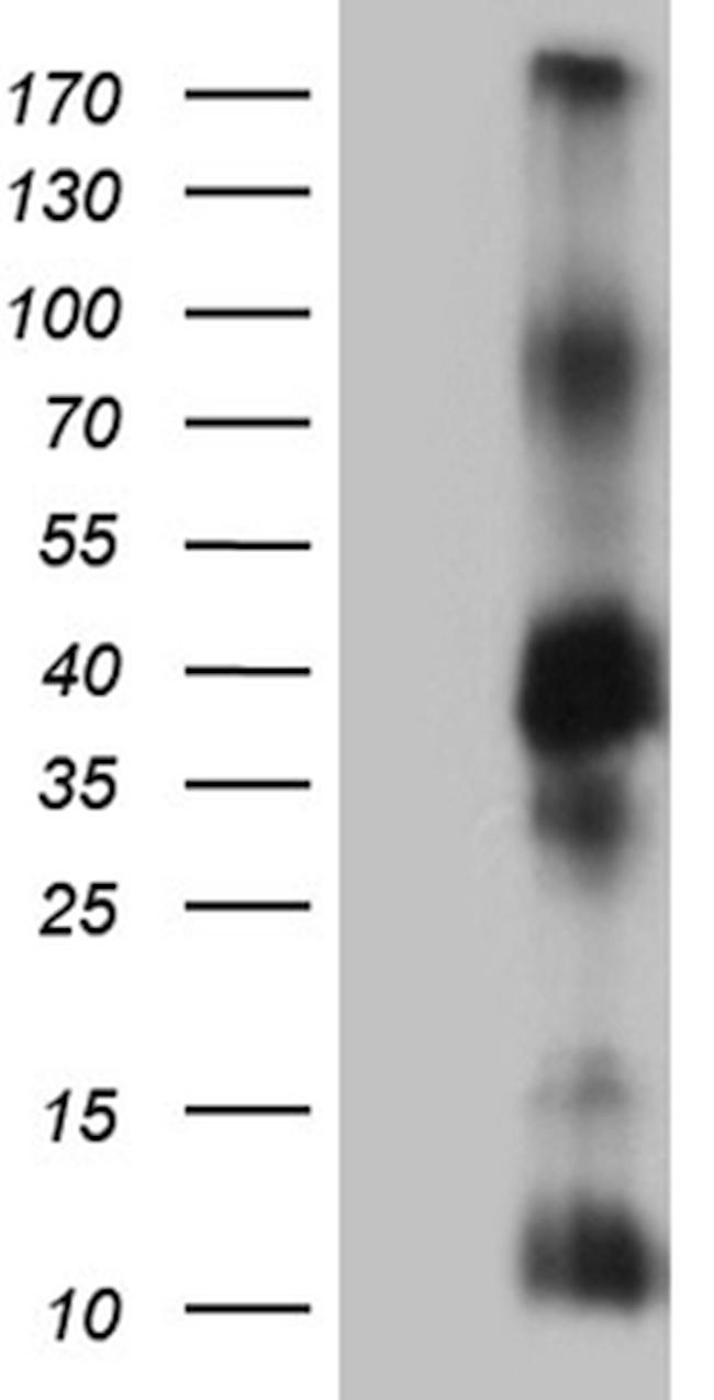ITM2A Antibody in Western Blot (WB)