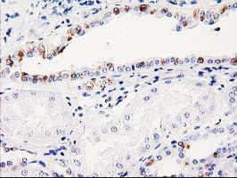 ITM2B Antibody in Immunohistochemistry (Paraffin) (IHC (P))