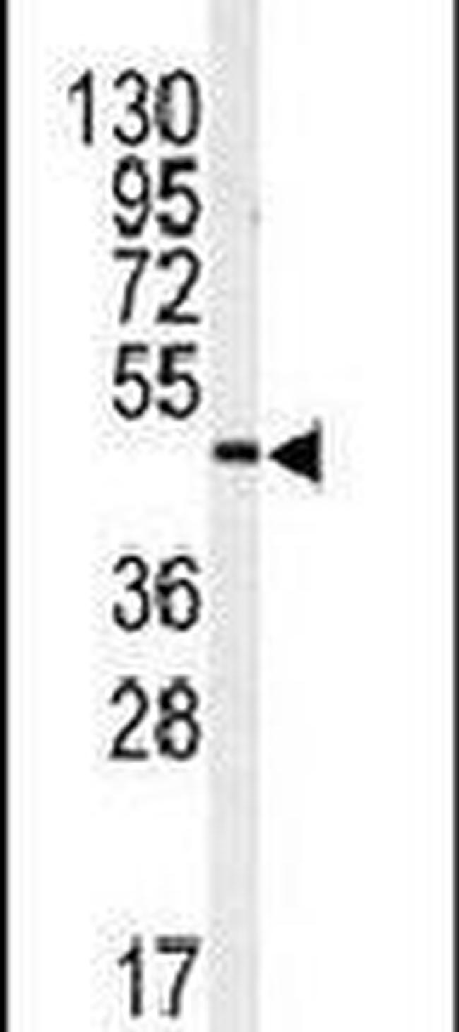 ITPKA Antibody in Western Blot (WB)