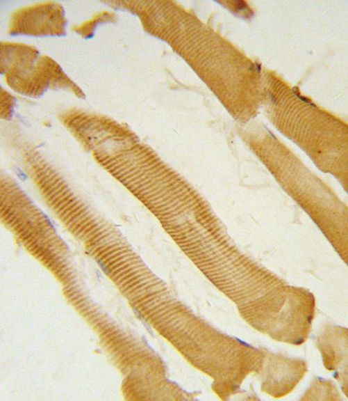 ITPKC Antibody in Immunohistochemistry (IHC)