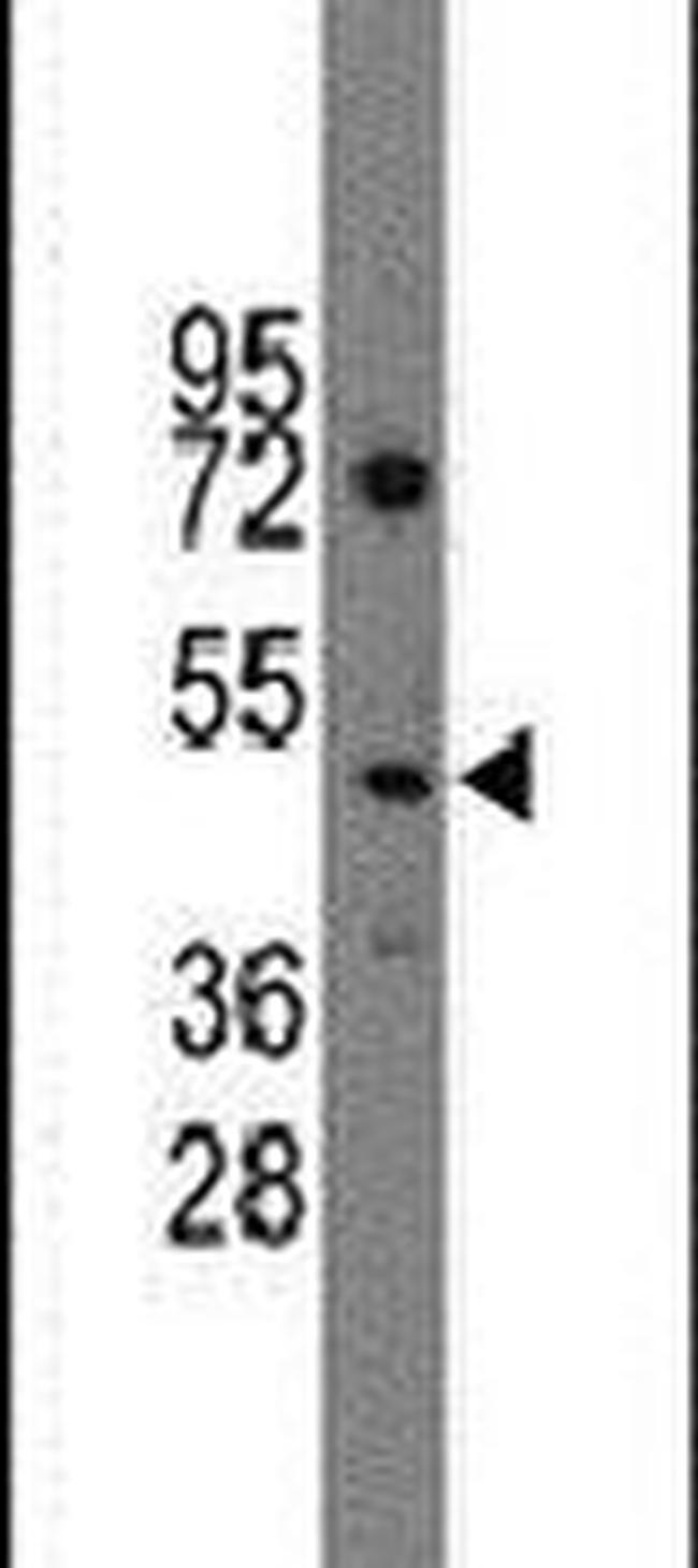 IHH Antibody in Western Blot (WB)