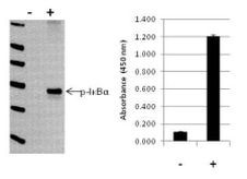 Human IkB alpha (Phospho) [pS32/pS36] InstantOne™ ELISA Kit