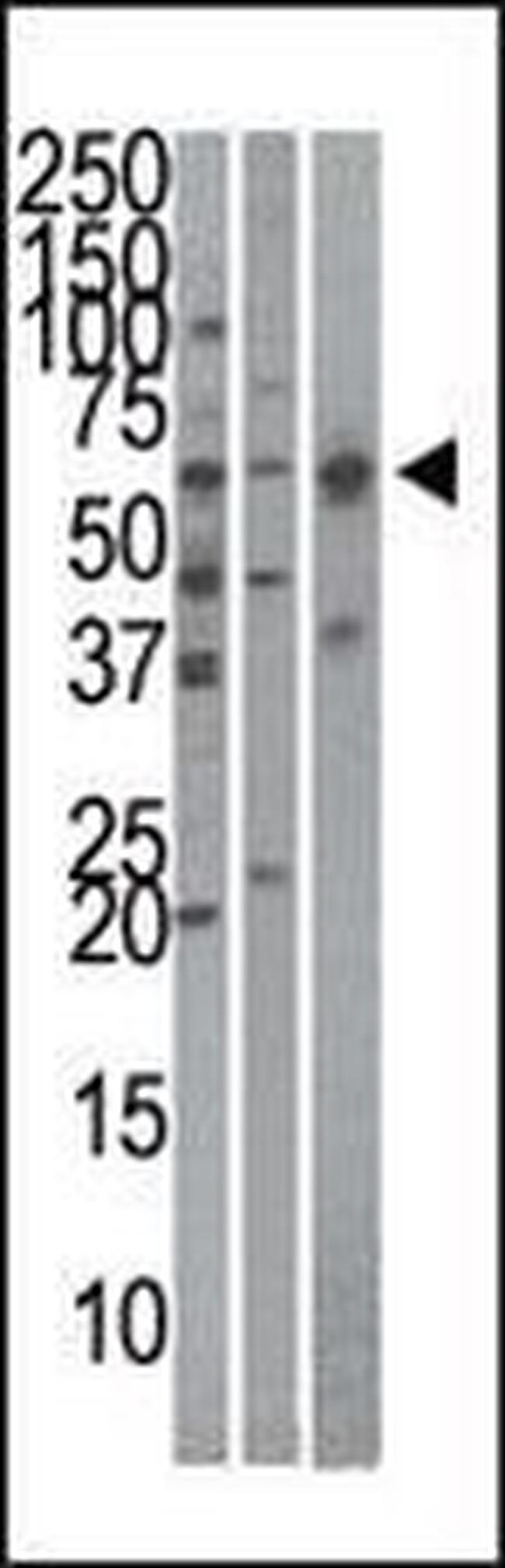 KPNA4 Antibody in Western Blot (WB)