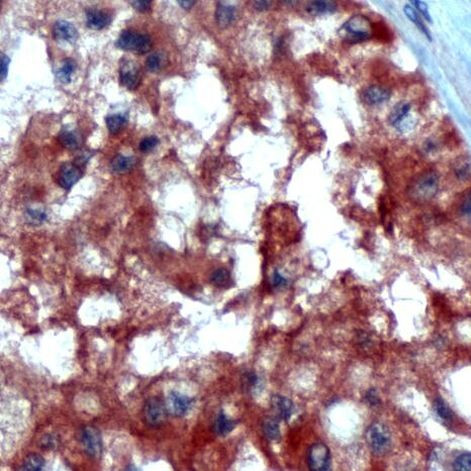 INHA Antibody in Immunohistochemistry (IHC)