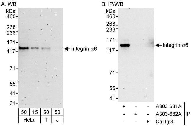 Integrin Wb Integrin Alpha 6 Polyclonal Antibody (A303-682A)