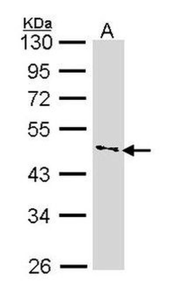 IFNGR1 Antibody in Western Blot (WB)
