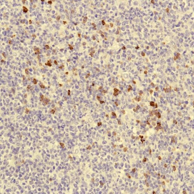 J Chain Antibody in Immunohistochemistry (IHC)