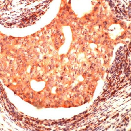 JAB1 Antibody in Immunohistochemistry (IHC)