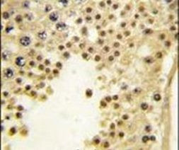 KDM2A Antibody in Immunohistochemistry (IHC)