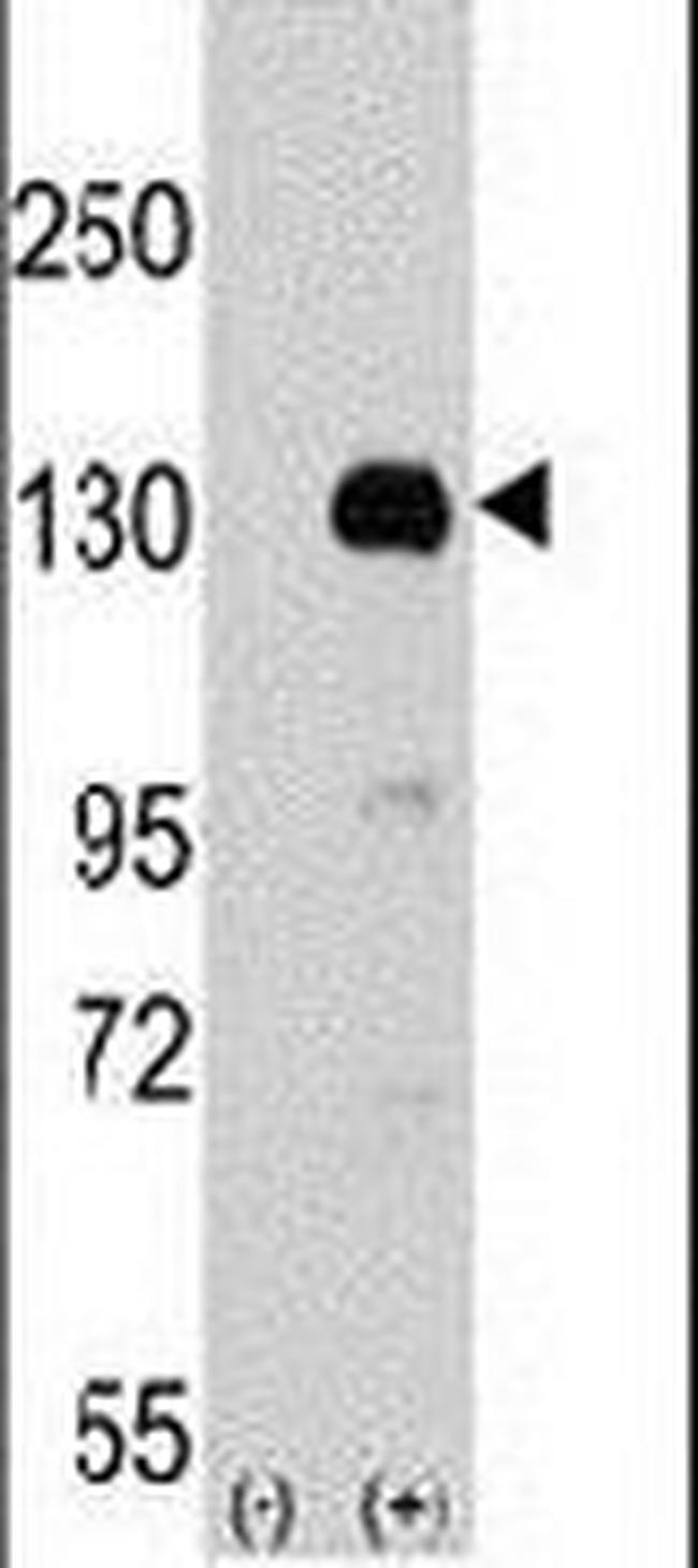 KDM2A Antibody in Western Blot (WB)