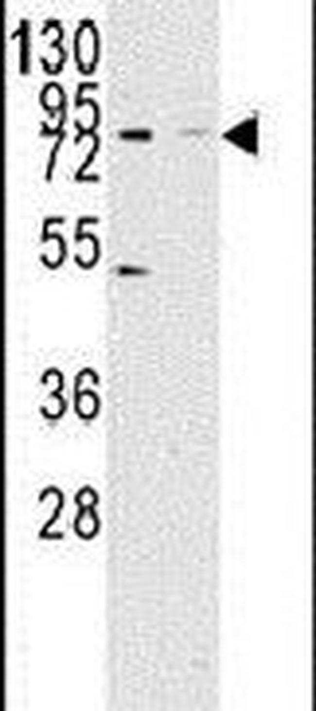 KDM2A Antibody in Western Blot (WB)