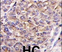 JIK Antibody in Immunohistochemistry (IHC)