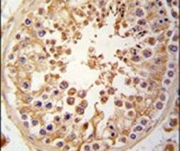 JLP Antibody in Immunohistochemistry (IHC)