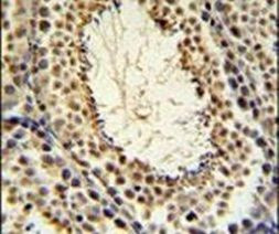 JMJD2B Antibody in Immunohistochemistry (IHC)
