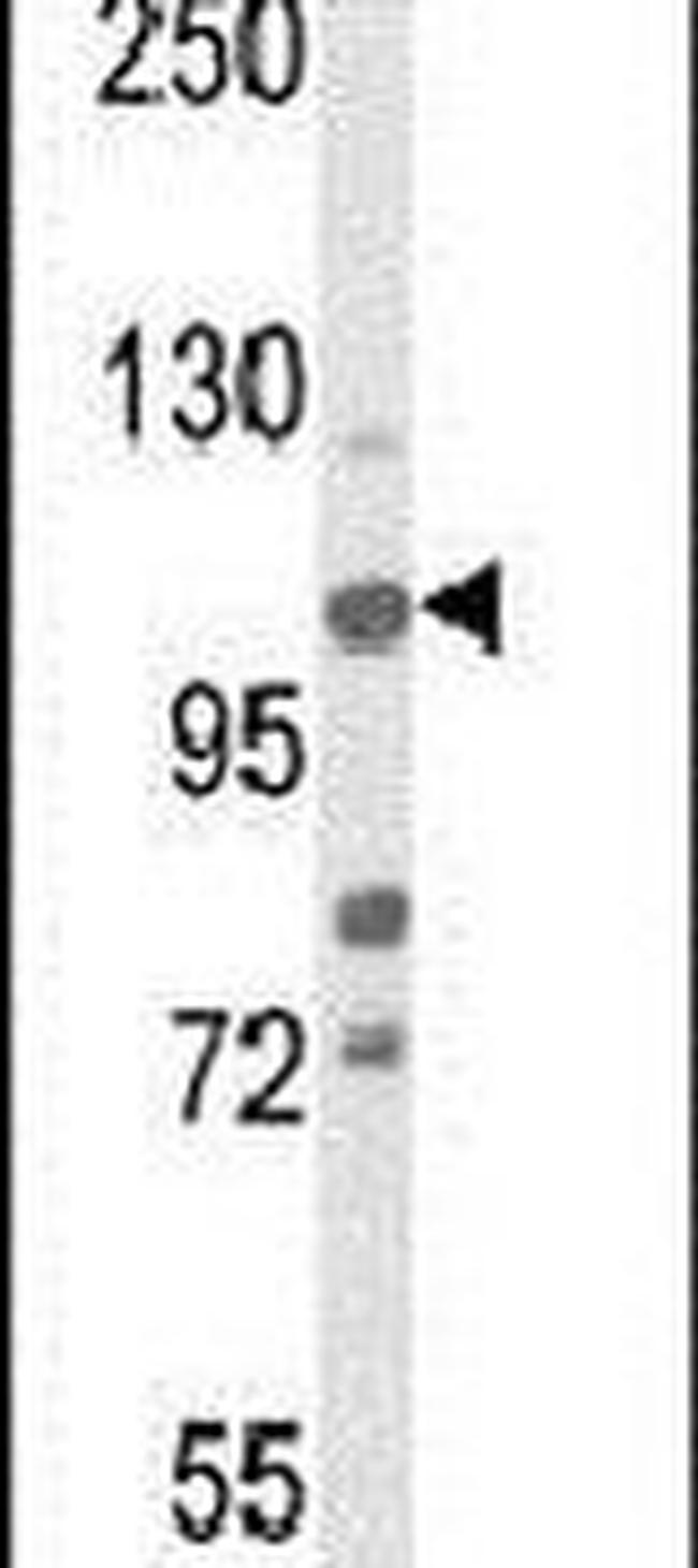 JMJD2B Antibody in Western Blot (WB)