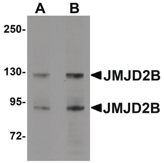 JMJD2B Antibody in Western Blot (WB)