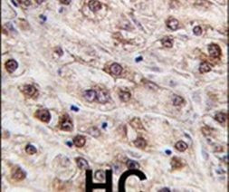 JMJD4 Antibody in Immunohistochemistry (IHC)