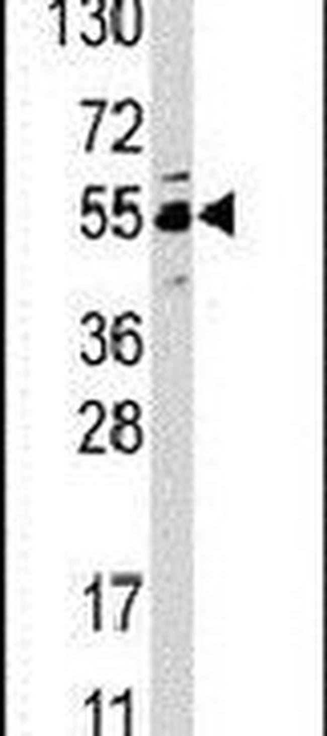 JMJD4 Antibody in Western Blot (WB)