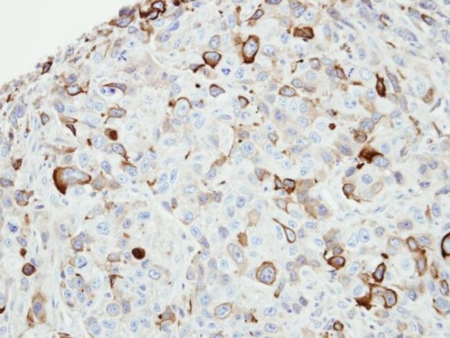 JNK1/JNK2 Antibody in Immunohistochemistry (IHC)