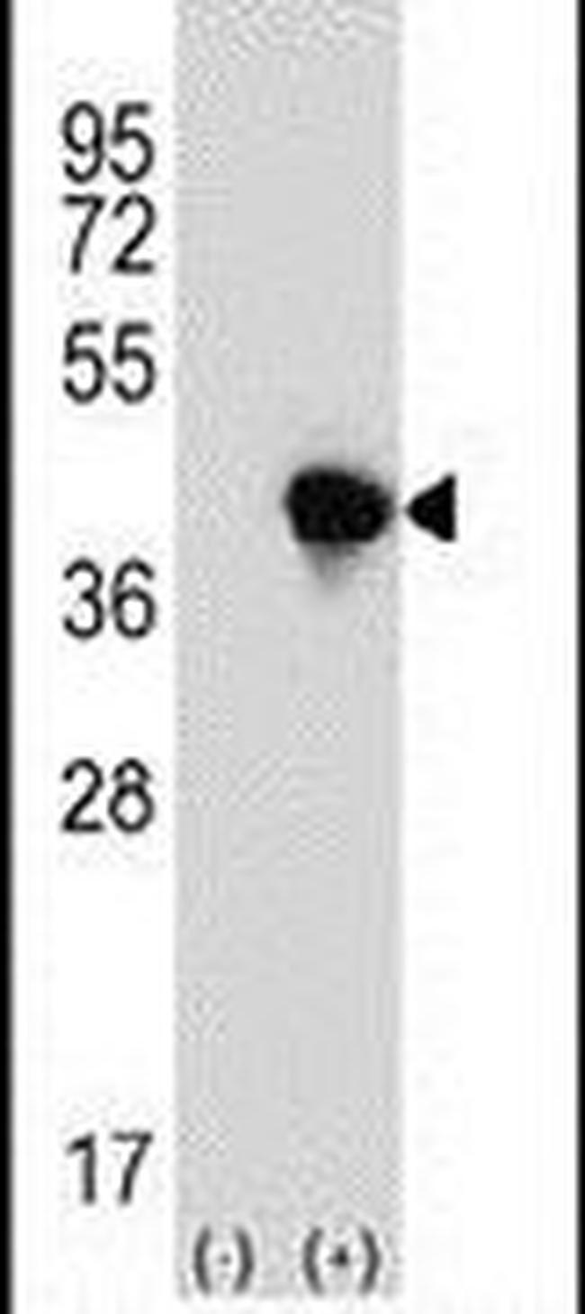 JTV-1 Antibody in Western Blot (WB)