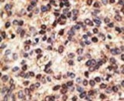 Jagged2 Antibody in Immunohistochemistry (IHC)