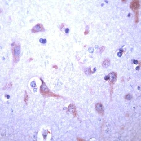JM4 Antibody in Immunohistochemistry (IHC)