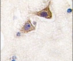 JPH3 Antibody in Immunohistochemistry (IHC)