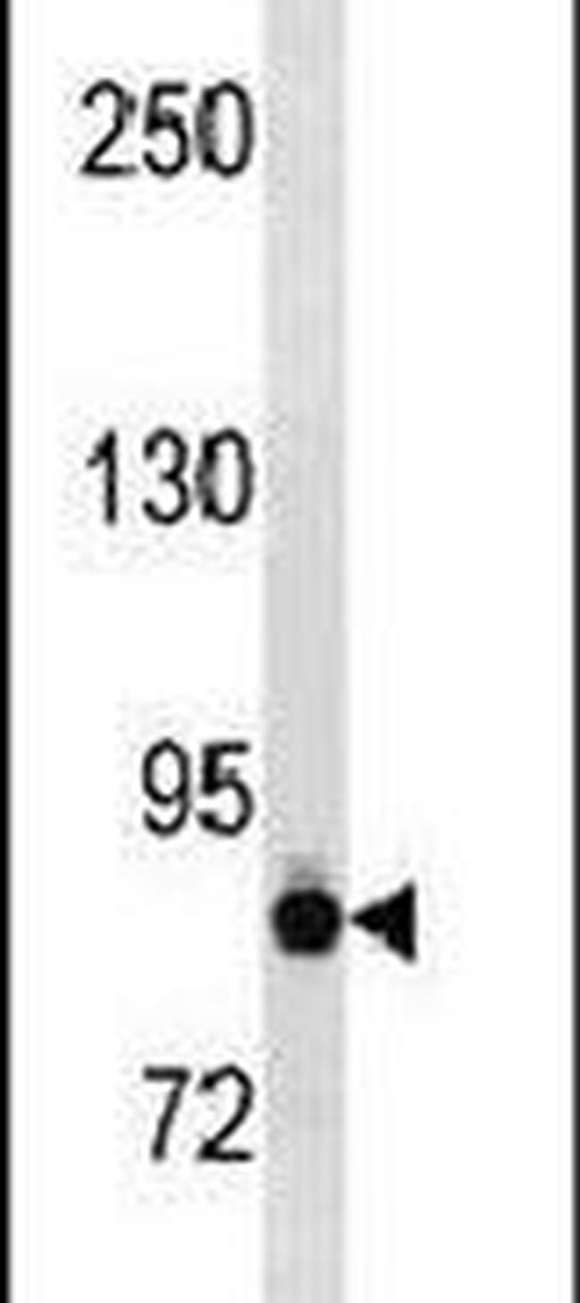 K-cadherin Antibody in Western Blot (WB)