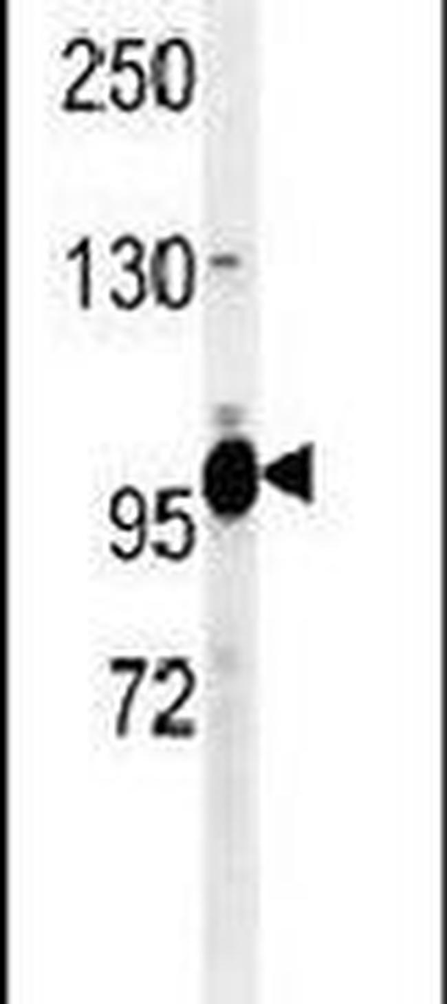 TTI1 Antibody in Western Blot (WB)