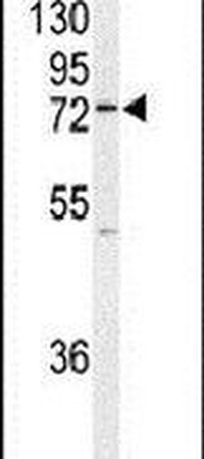 UFL1 Antibody in Western Blot (WB)