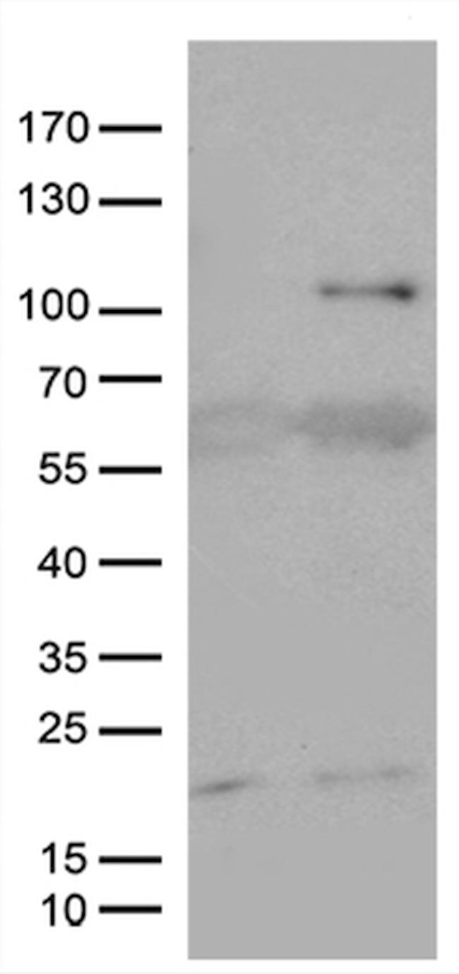 KAL1 Antibody in Western Blot (WB)