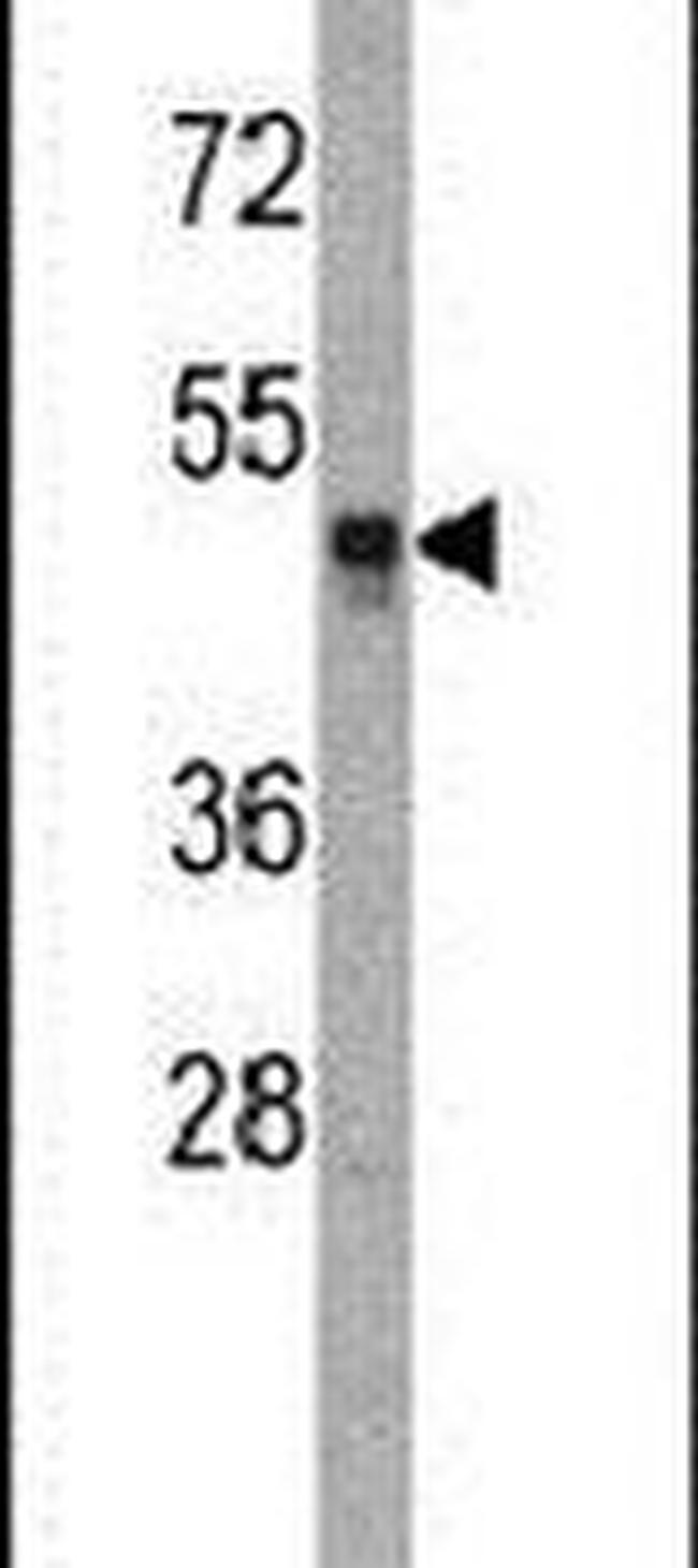 HAT1 Antibody in Western Blot (WB)