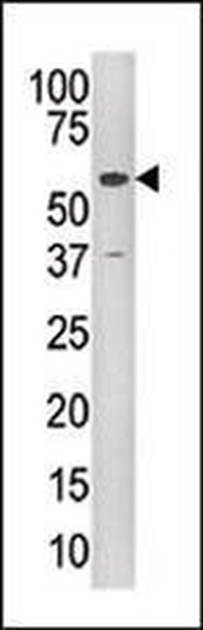 TIP60 Antibody in Western Blot (WB)