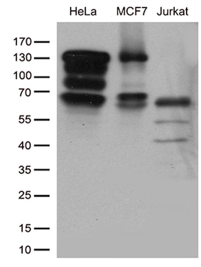 KAT5 Antibody in Western Blot (WB)