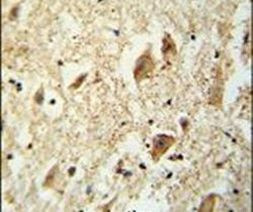 KATNAL1 Antibody in Immunohistochemistry (IHC)
