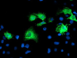 KATNB1 Antibody in Immunocytochemistry (ICC/IF)